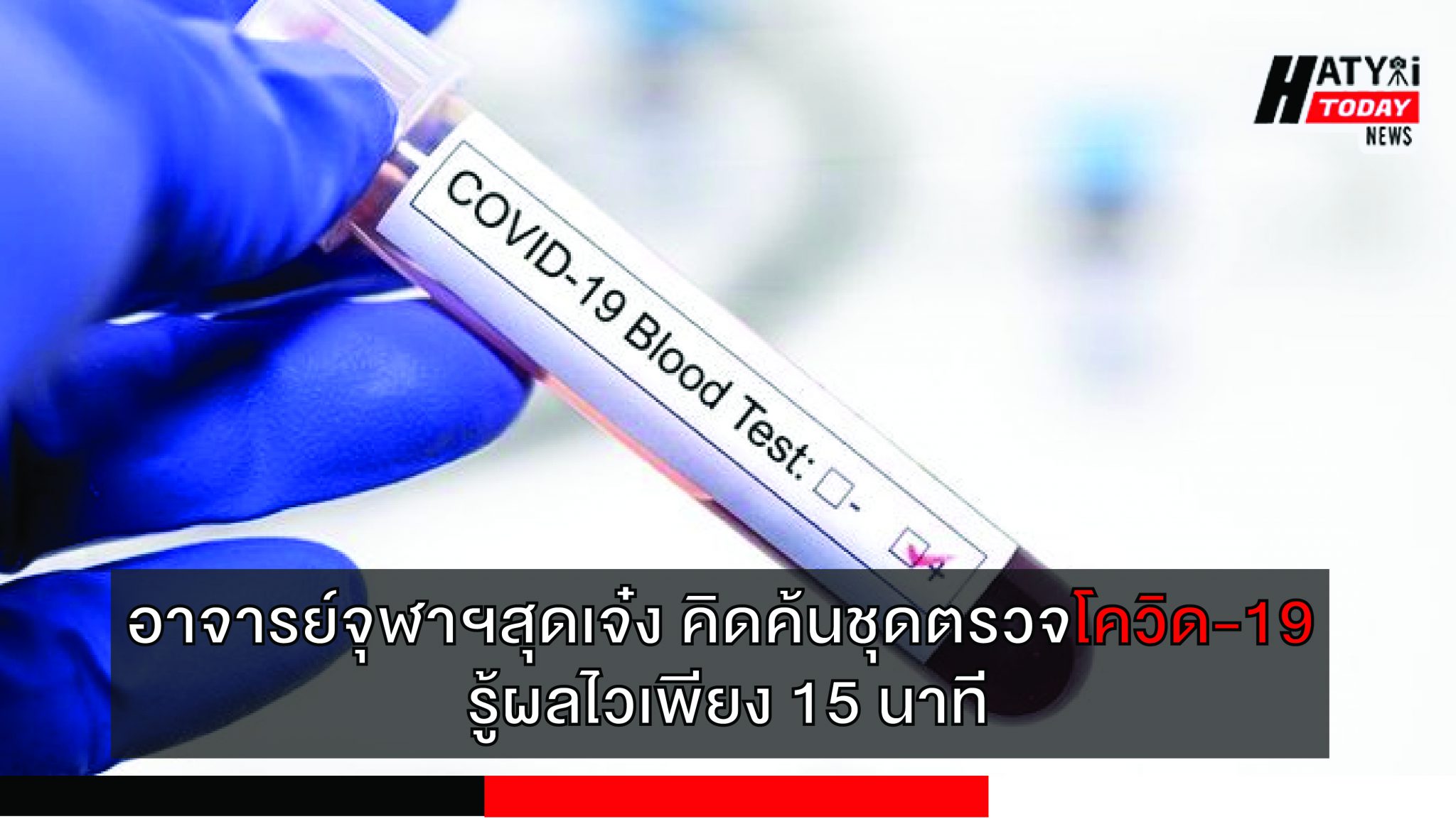 อาจารย์จุฬาฯสุดเจ๋ง คิดค้นชุดตรวจโควิด-19 รู้ผลไวเพียง 15 นาที