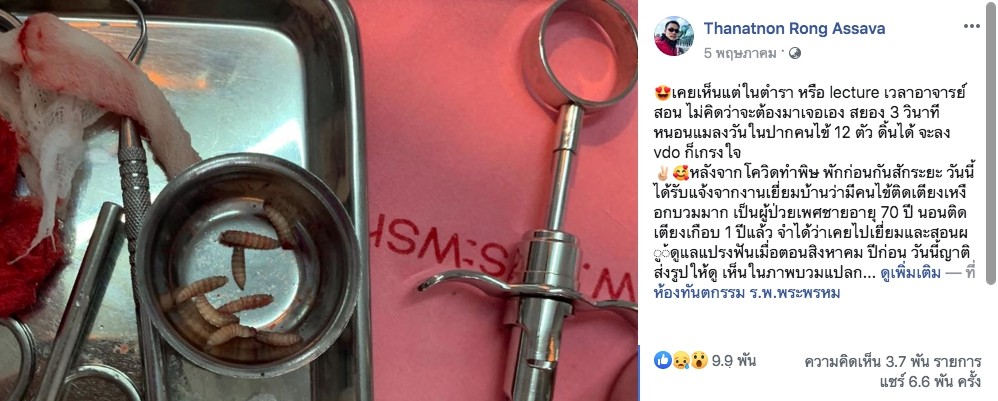 สุดช็อก ! เมืองนคร ทีมทันตแพทย์พบผู้ป่วยติดเตียง หนอนเต็มปากหลังถอนฟัน 2 1588836910745 HATYAITODAY