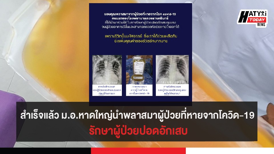 สำเร็จแล้ว ม.อ.หาดใหญ่นำพลาสมาผู้ป่วยที่หายจากโควิด-19 รักษาผู้ป่วยปอดอักเสบ