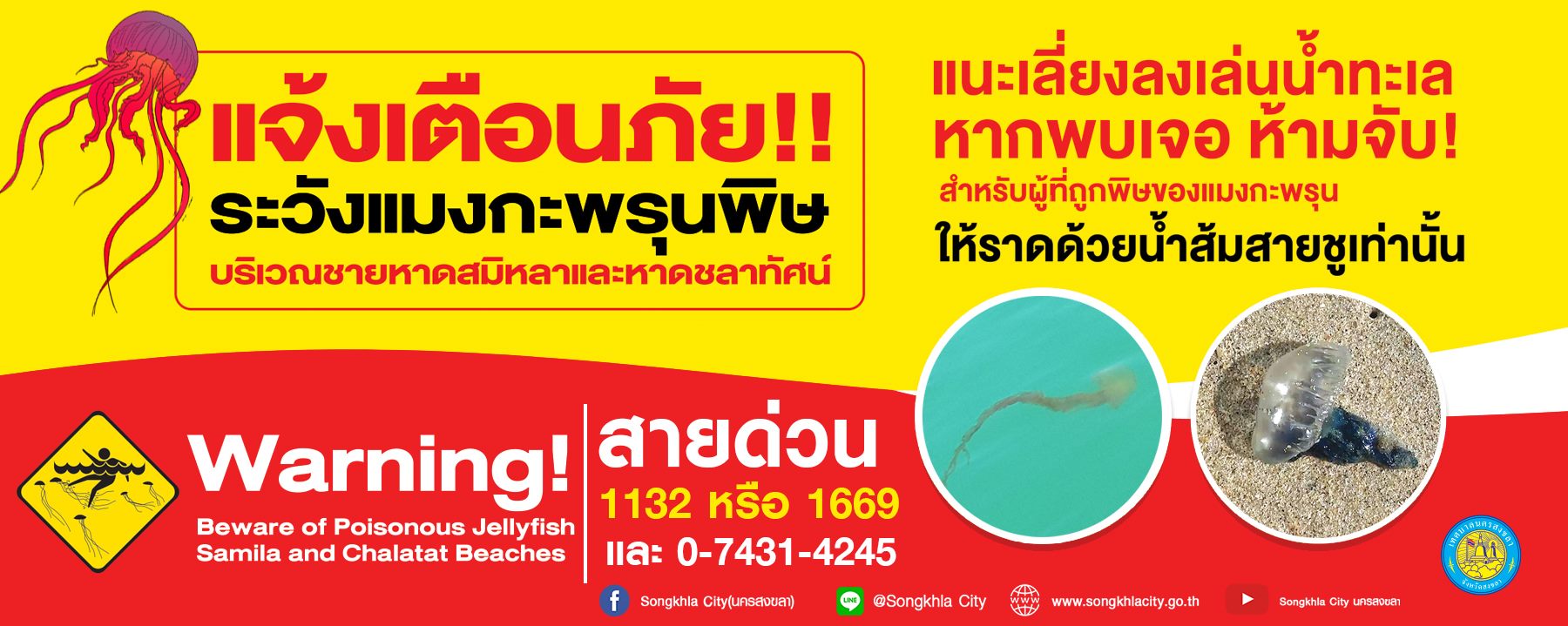 หาดสมิหลา สงขลา ยังไม่พ้นวิกฤตแมงกะพรุนพิษ ยังคงพบนักท่องเที่ยวถูกแมงกะพรุนพิษ 