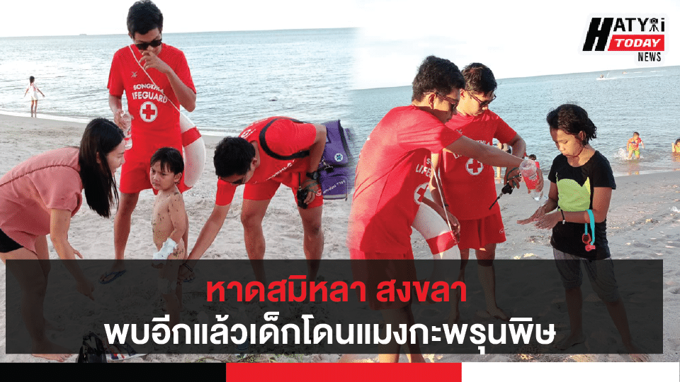 จ.สงขลา ชุด life guard ลงพื้นที่หาดสมิหลา เตือนนักท่องเที่ยวให้ระวังแมงกระพรุนพิษ