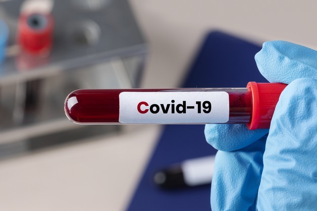 surgeon holding coronavirus blood test tube 53876 95286 HATYAITODAY