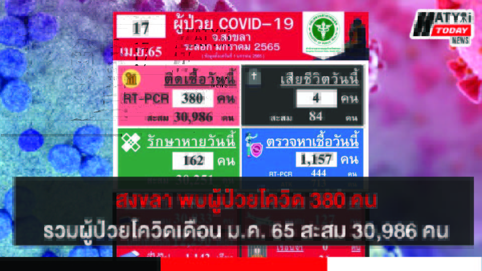 สงขลา พบผู้ป่วยโควิด 380 คน รวมผู้ป่วยโควิดระลอกเดือน ม.ค. 65 สะสม 30,986 คน