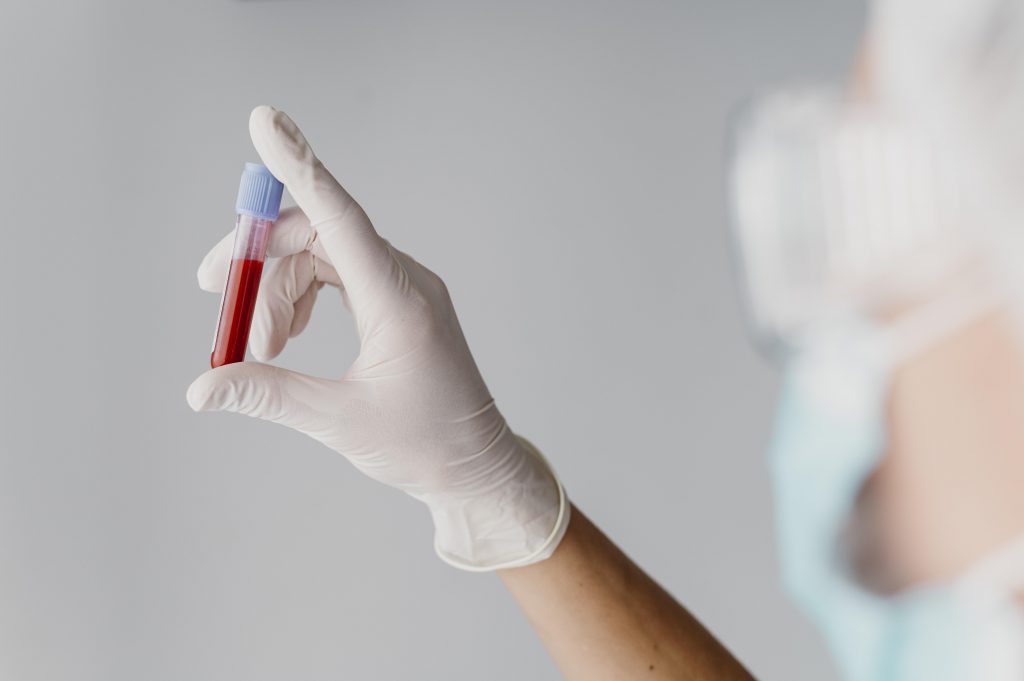 Back View Doctor Holding Blood Sample