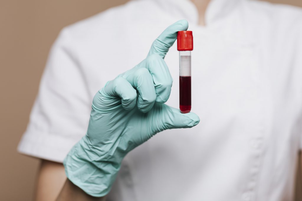 Nurse Holding A Blood Test Tube