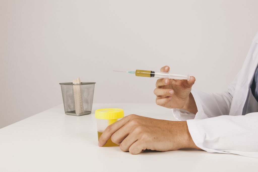 Doctor S Hands With Urine Test Syringe